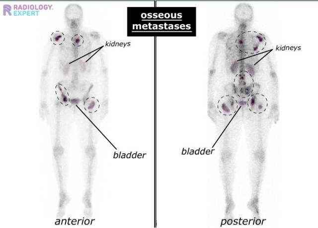 RadiologyExpert_English_module